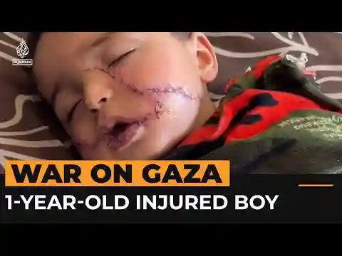 Injured Gaza 1-year-old suffers 200 facial stitches and hand amputation | Al Jazeera Newsfeed
