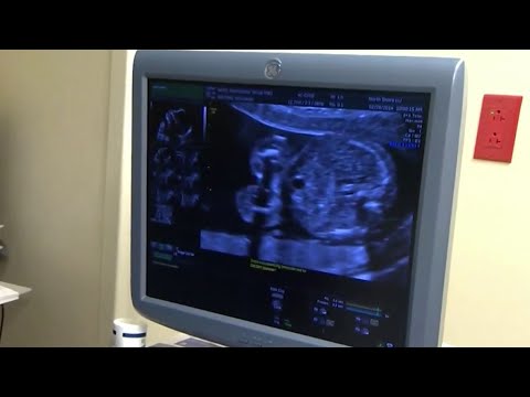 New abortion bill heads to Florida Gov. DeSantis