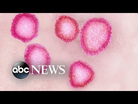 Officials warn coronavirus will affect more Americans after Chicago woman diagnosed